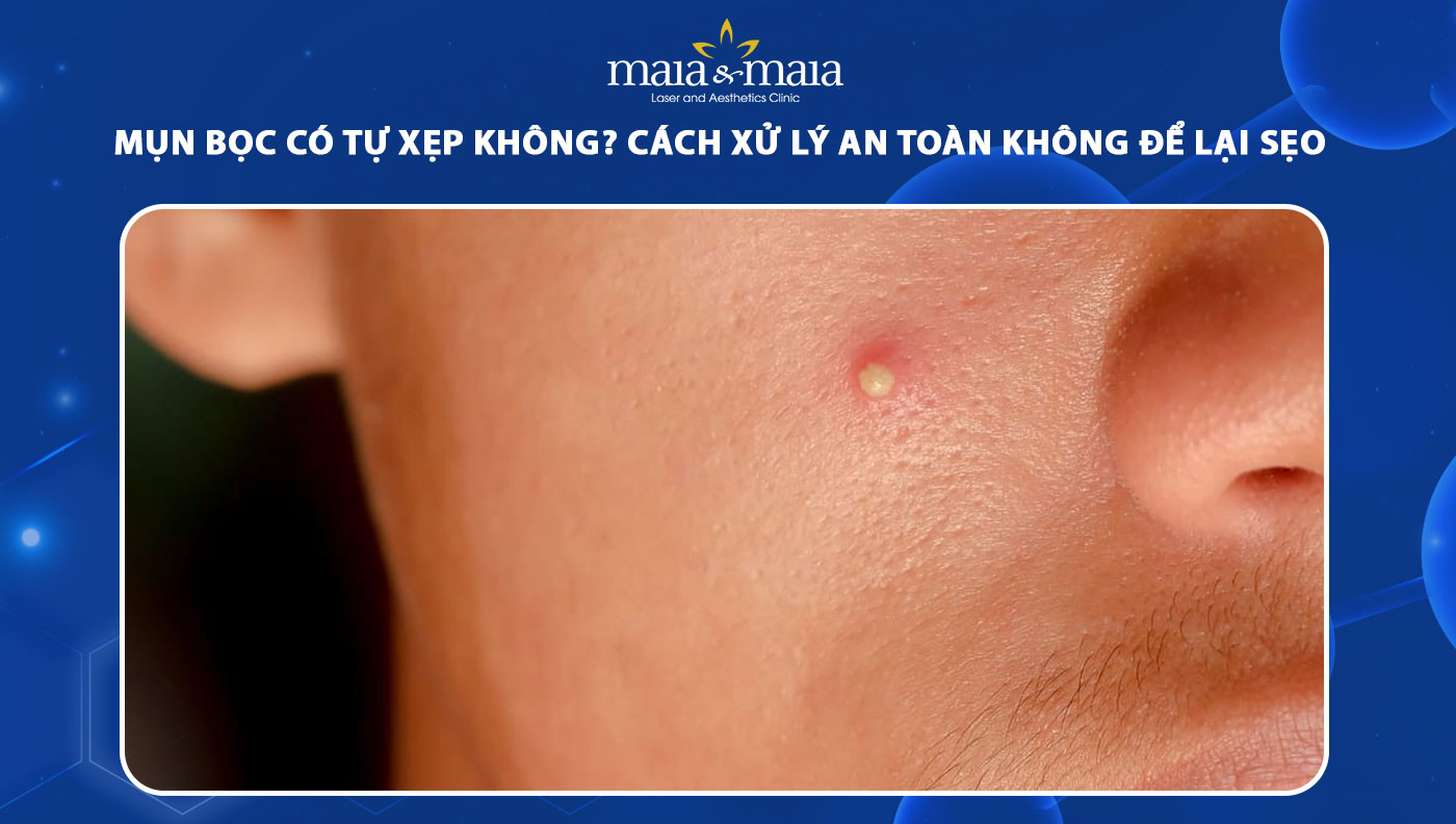 mụn bọc có tự xẹp không