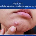 mụn bọc ở cằm