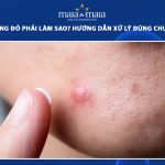 mụn bọc sưng đỏ