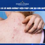 mụn trứng cá có ngứa không