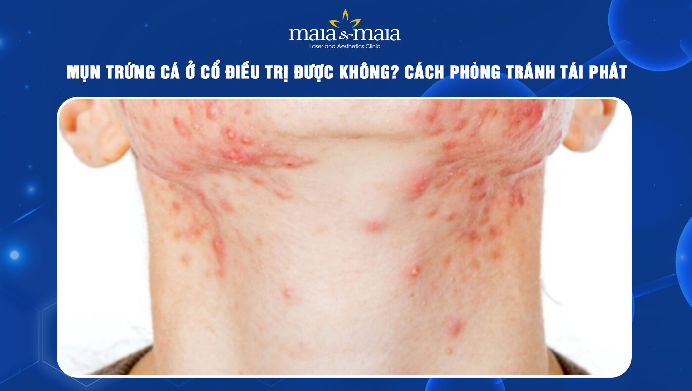 mụn trứng cá ở cổ