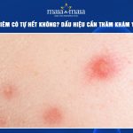 mụn viêm có tự hết không