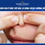 nặn mụn đầu đen ở mũi