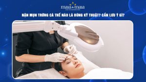 nặn mụn trứng cá