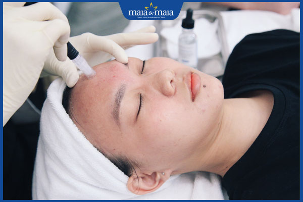 Có nên hút mủ mụn nhọt không? Quy trình thực hiện 3 quy trình hút mủ mụn