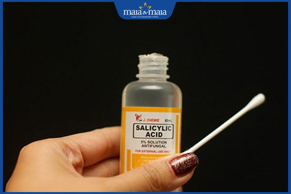 Mụn cám quanh miệng có đặc điểm gì? Cách điều trị hiệu quả 3 salicylic acid