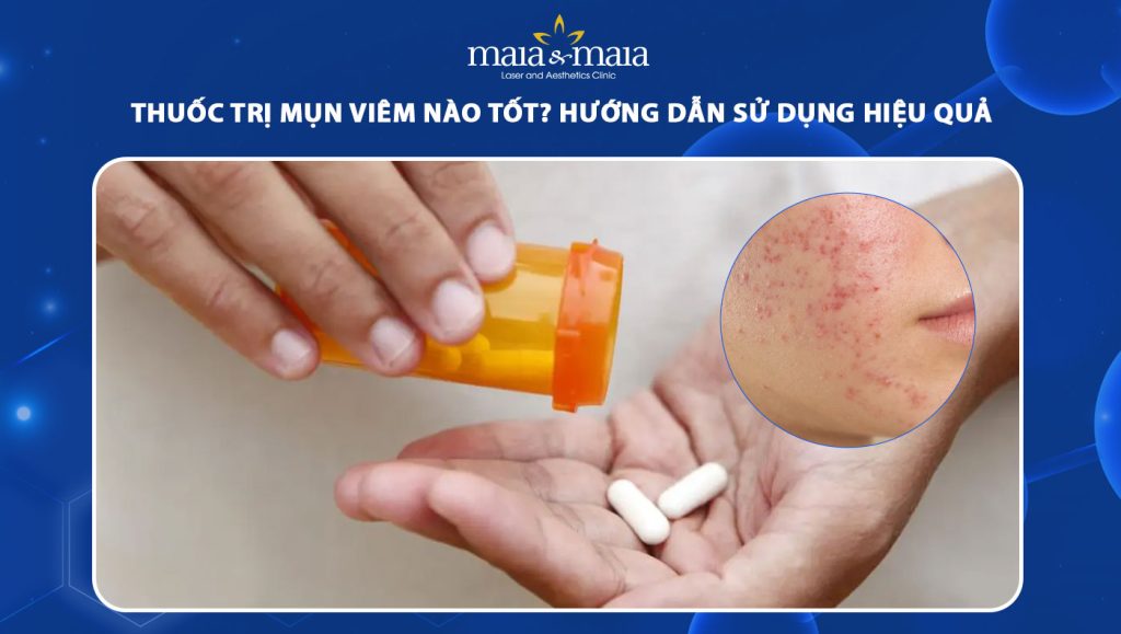 thuốc trị mụn viêm