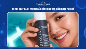trị mụn ẩn bằng bha
