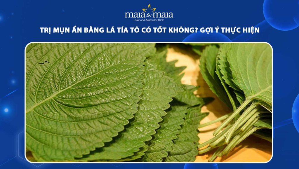 trị mụn ẩn bằng lá tía tô