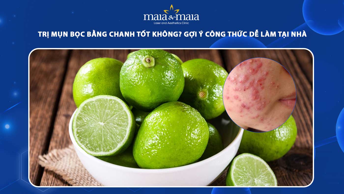 trị mụn bọc bằng chanh