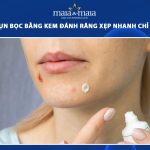 trị mụn bọc bằng kem đánh răng