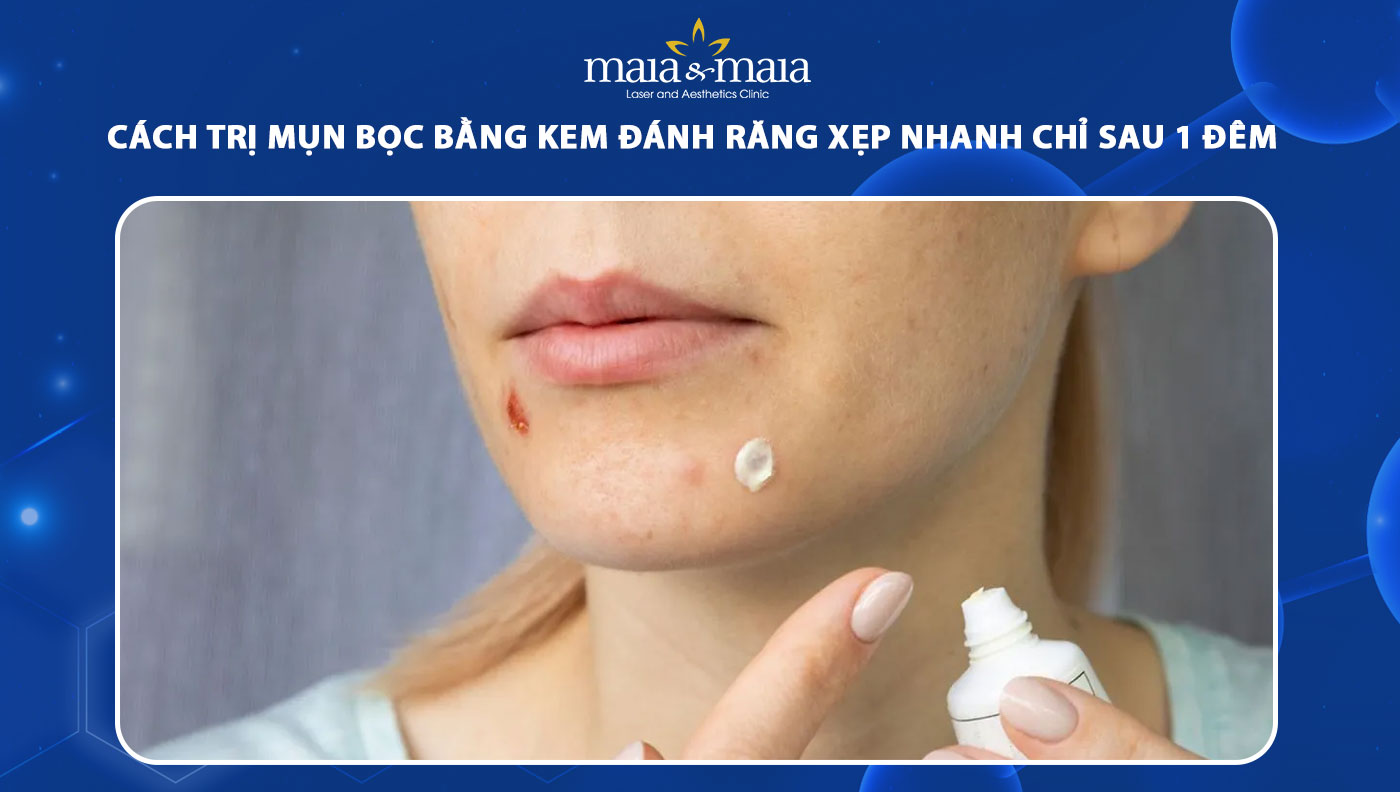 trị mụn bọc bằng kem đánh răng