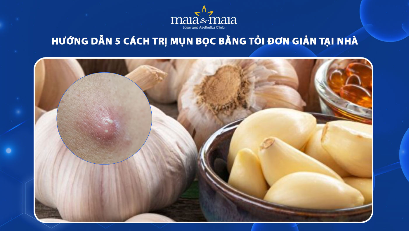 trị mụn bọc bằng tỏi