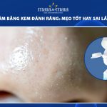 trị mụn cám bằng kem đánh răng