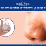 trị mụn đầu đen bằng dầu em bé