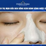 trị mụn đầu đen bằng kem đánh răng
