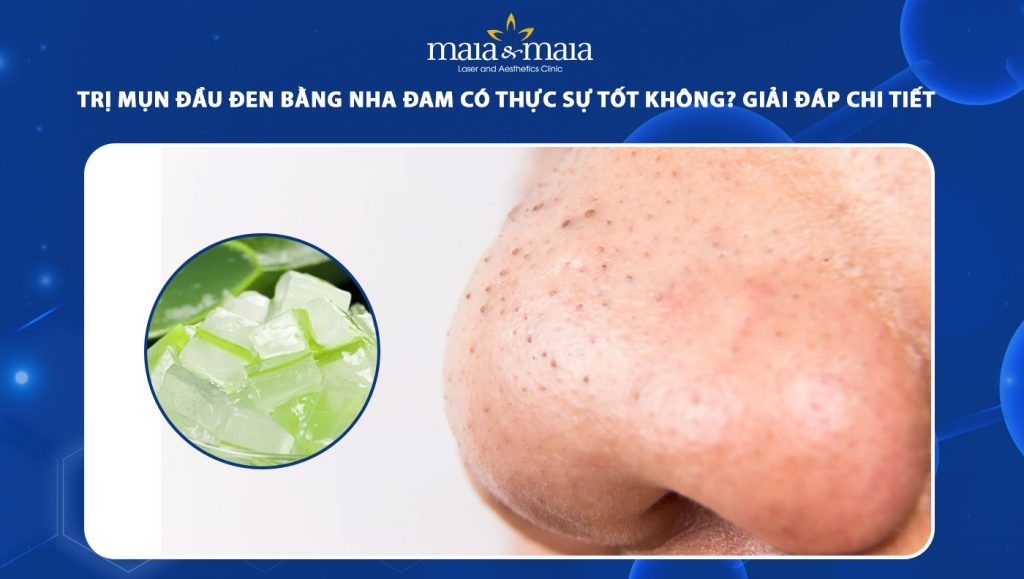 Trị mụn đầu đen bằng nha đam có thực sự tốt không? 1 trị mụn đầu đen bằng nha đam