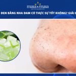 trị mụn đầu đen bằng nha đam
