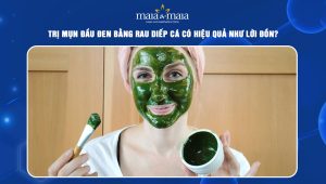 trị mụn đầu đen bằng rau diếp cá