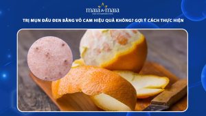 trị mụn đầu đen bằng vỏ cam