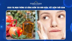 trị mụn trứng cá bằng giấm táo