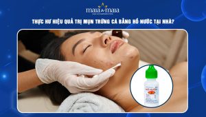 trị mụn trứng cá bằng hồ nước