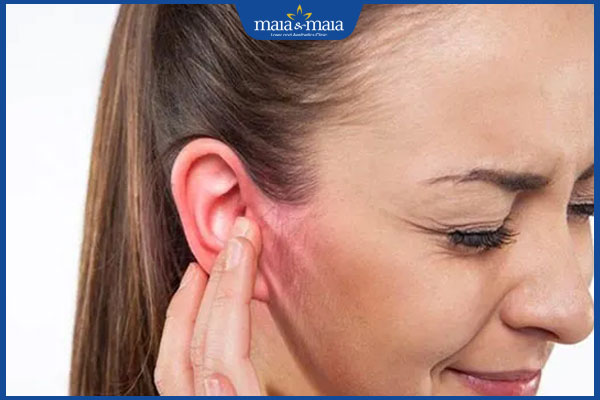 Mụn đầu đen trong lỗ tai có dấu hiệu gì? Cách xử lý hiệu quả 3 tự ý nặn mụn trong lỗ tai