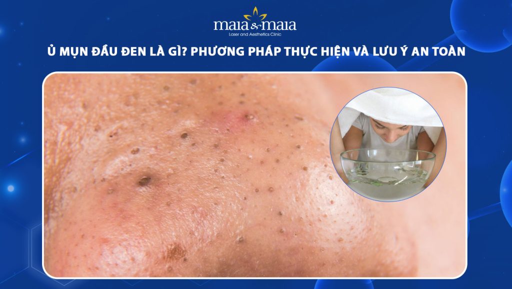 Ủ mụn đầu đen là gì? Phương pháp thực hiện và lưu ý an toàn 1 ủ mụn đầu đen