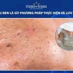 ủ mụn đầu đen