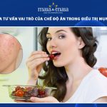 vai trò của chế độ ăn trong điều trị mụn trứng cá