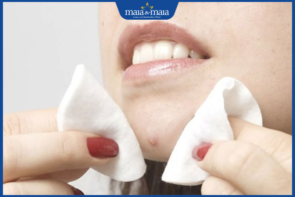 vệ sinh mụn đinh râu