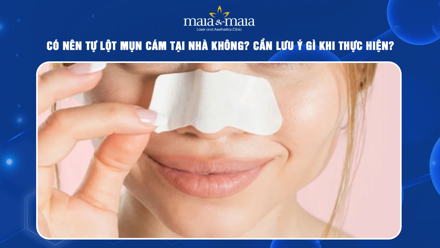 lột mụn cám tại nhà